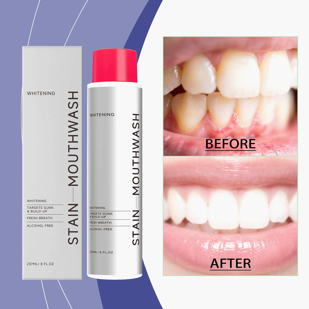 AMZ 237ml Mouthwash Is a Portable Daily Mouthwash That Gently Cleans the Mouth and Leaves a Pleasant Smell