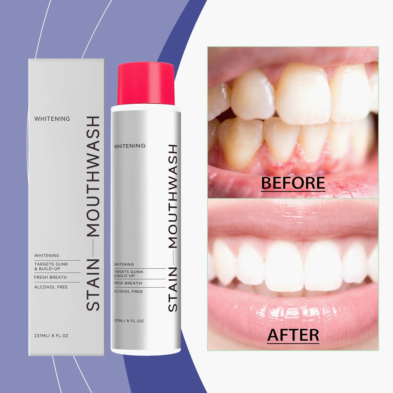 AMZ 237ml Mouthwash Is a Portable Daily Mouthwash That Gently Cleans the Mouth and Leaves a Pleasant Smell