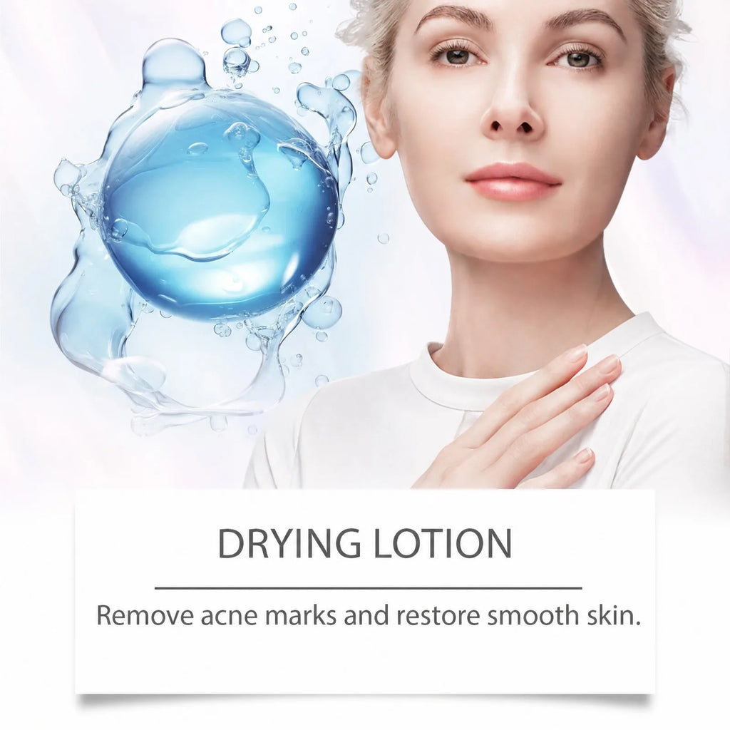 Acne Buster Salicylic Acid Drying Lotion Acne Spot Care Blemish Care Tea Tree Aloe Vera Pore Care Clear Skin Facial Essence 10ml