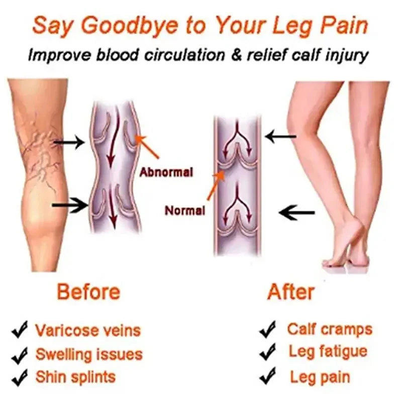 1pair Women Compression Socks Slimming Sock Men Outdoor Sports Prevent Calf Soreness Pressure Calf Stocking Sock