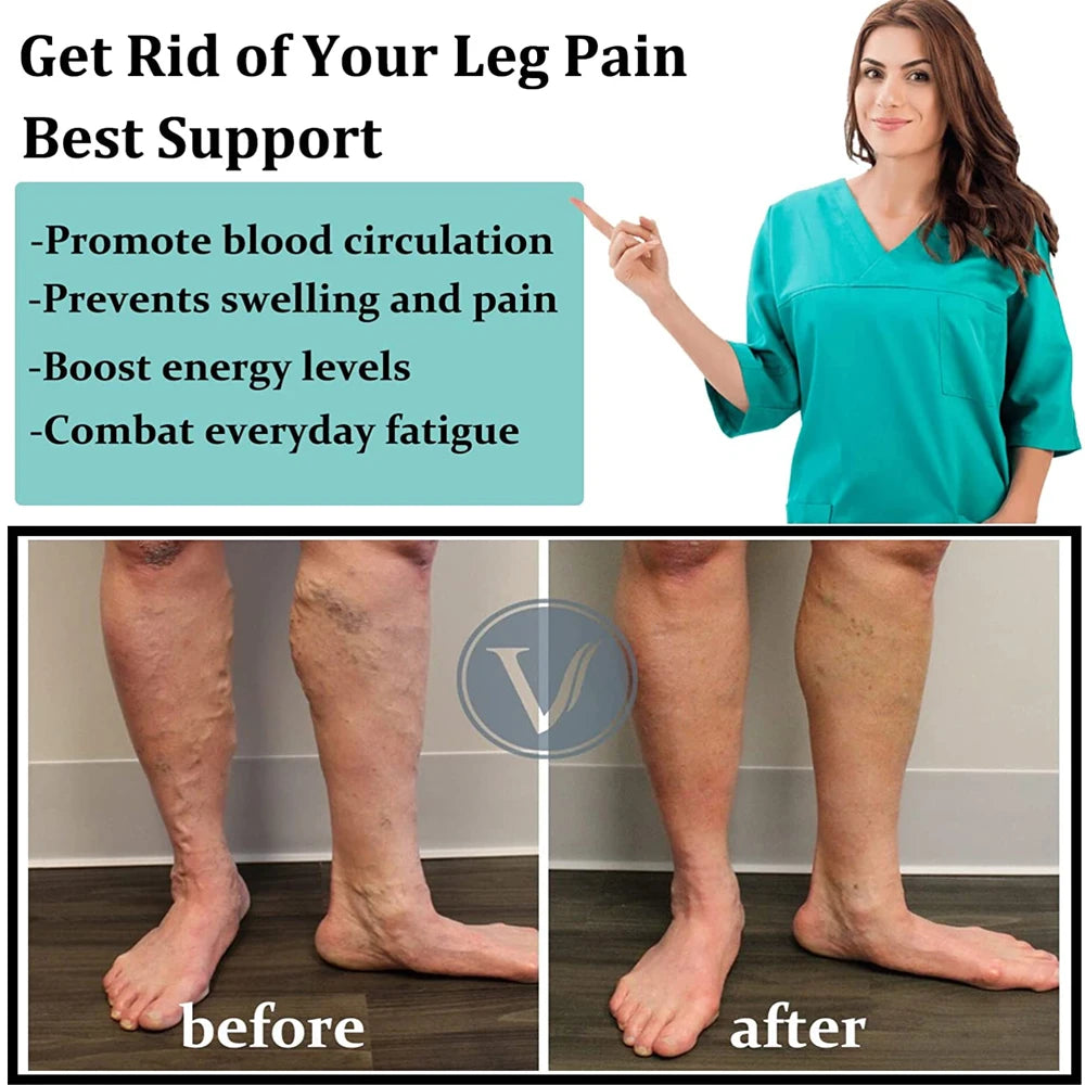 1Pair Unisex Copper Compression Socks Women Men Anti Fatigue Pain Relief Knee High Stockings 15-20 mmHg Graduated  for Running