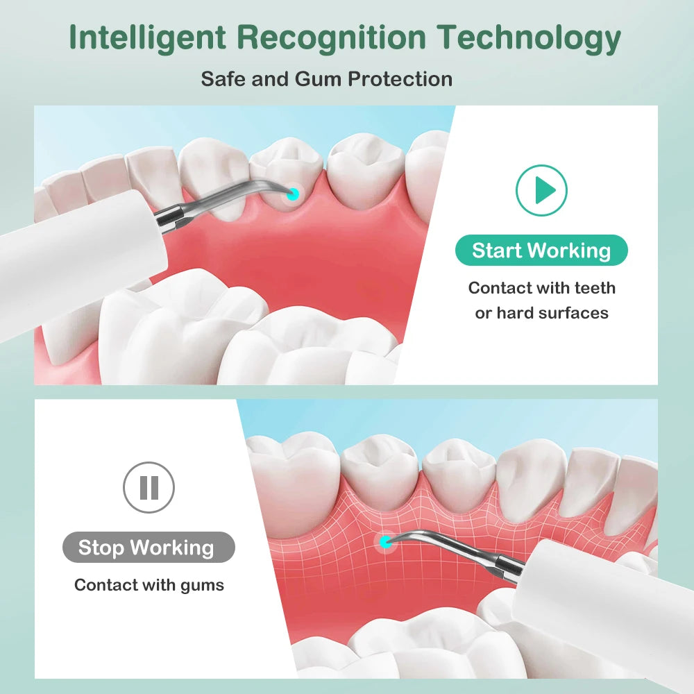 Intelligent Ultrasonic Dental Scaler Teeth Tartar Remover 5 Modes Electric LED Teeth Cleaner Tooth Stone Calculus Plaque Removal