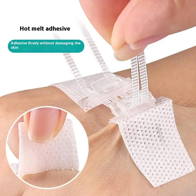 Zipper Tie Wound Closure Patch Hemostatic Patch Wound Fast Without Suture Zipper Outdoor Band-Aid Portable Quick Clot Wound