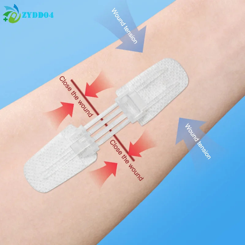 ●Zipper Band-aid Painless Wound Closure Patch Suture-free Wound Dressing Patches Zip Suture Reducer Band Aid Outdoor Portable