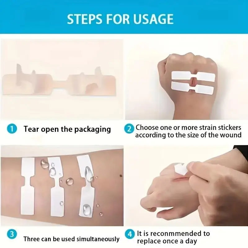 New 80 Butterfly-shaped Wound Closure Strips Wound Closure And Suture Dressing Suitable For Outdoor Sports Travel First AidAcc