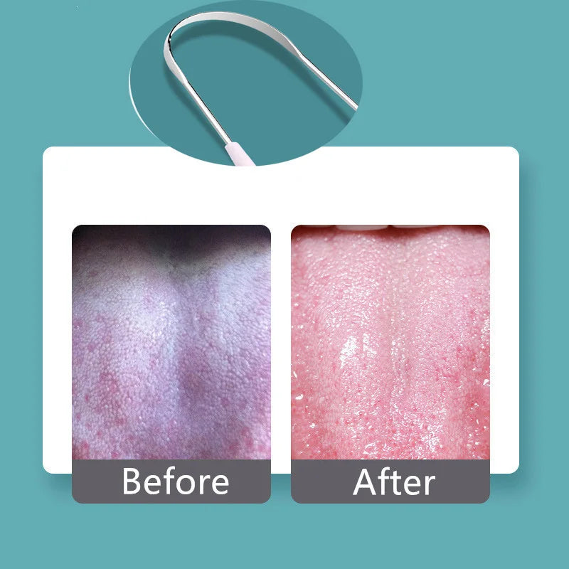 Hot 1PC Stainless Steel Tongue Scraper Cleaner Fresh Breath Cleaning Coated Tongue Toothbrush Oral Hygiene Care Tools