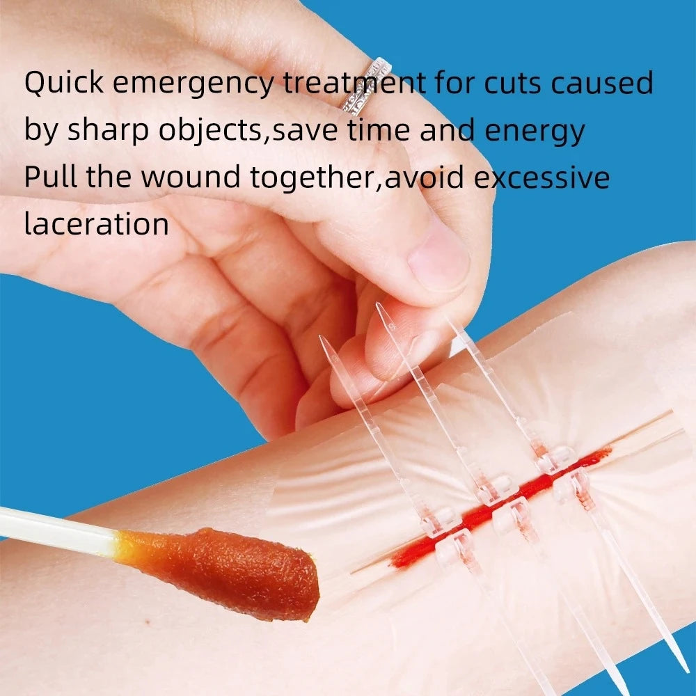 10 Pieces of Outdoor Camping Home Zipper Hemostatic Tape, Wound Closure Tape, Quick Suture Zipper Adhesive Tape, Easy to Carry