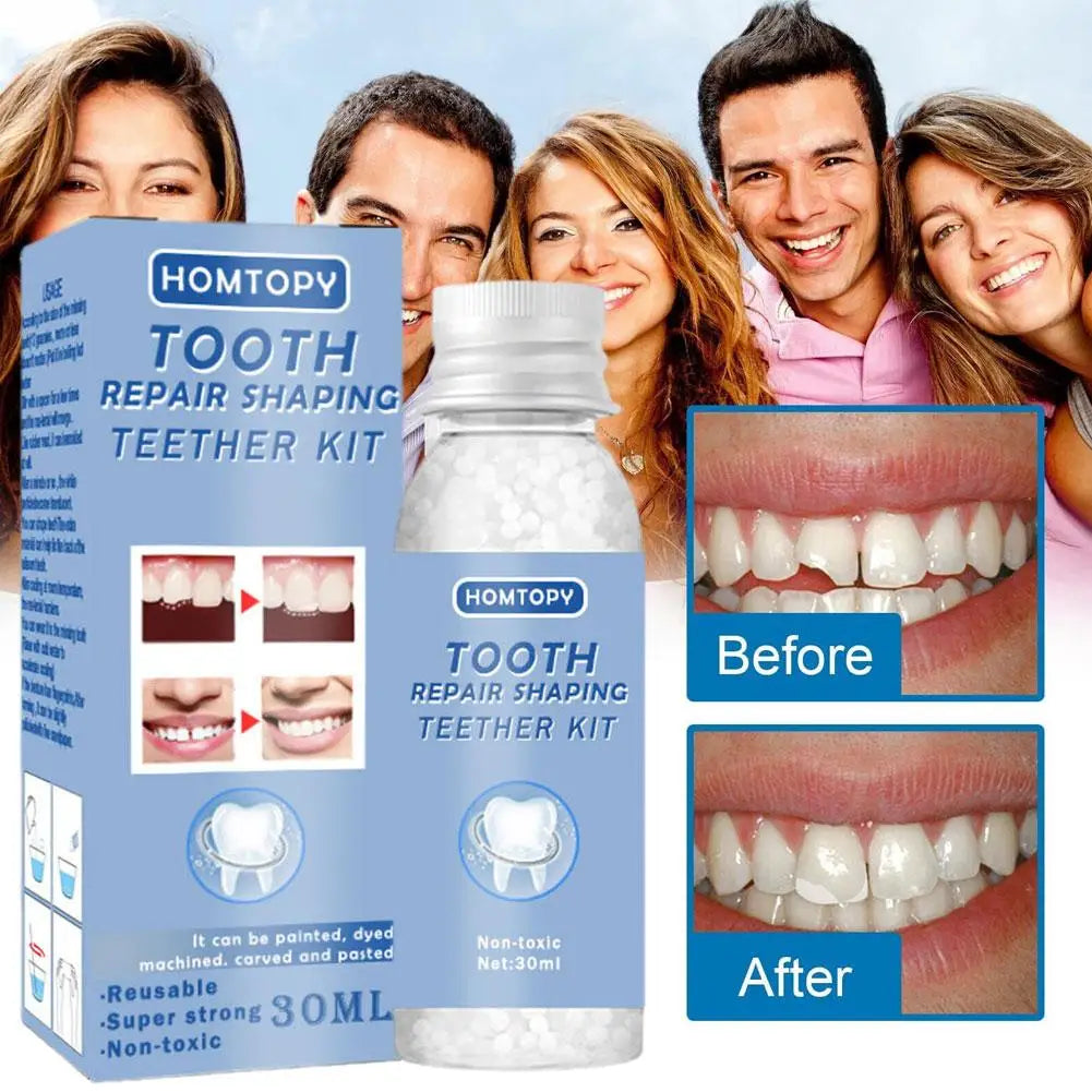 Teeth Repair Glue 30ml for Fixing The Missing and Broken Tooth Replacements Temporary Moldable False Teeth Dental Repair Ki U9Y7