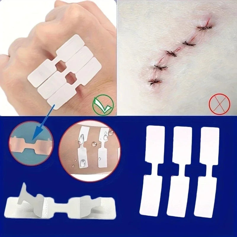 5Pcs Emergency Wound Closure Tape - Outdoor First Aid Adhesive Suture Strips for Quick Wound Repair & Bandage