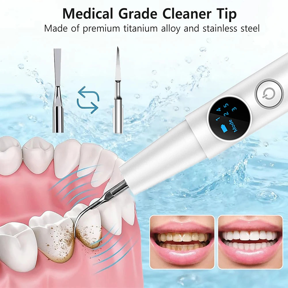 Ultrasonic Scaler Plaque Remover for Teeth Dental Calculus Remover with 5 Modes Teeth Cleaning Kit Sonic Tartar Remover