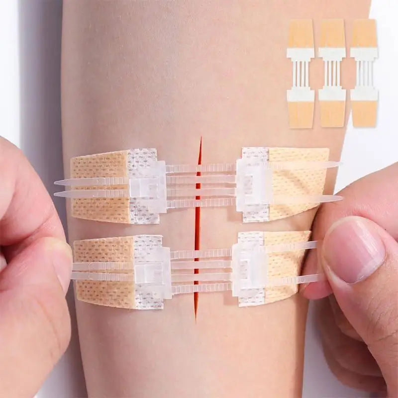Zipper Band Aid Painless Wound Closure Patch Suture Free Waterproof Bandage First Aid Supplies for Camping and Hiking