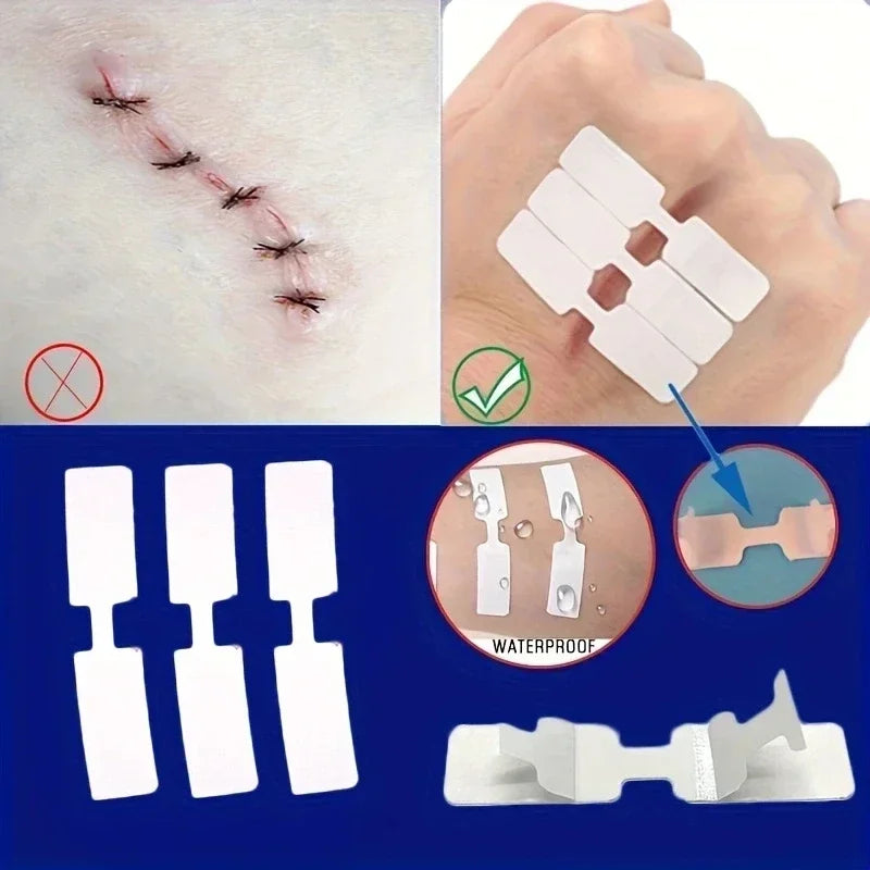 5Pcs Emergency Wound Closure Tape - Outdoor First Aid Adhesive Suture Strips for Quick Wound Repair & Bandage