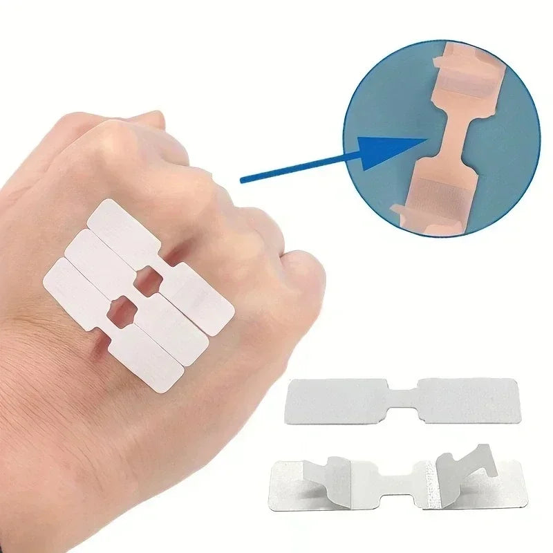 10/30/50/100Pcs Emergency Wound Closure Tape - Outdoor First Aid Adhesive Suture Strips for Quick Wound Repair & Bandage