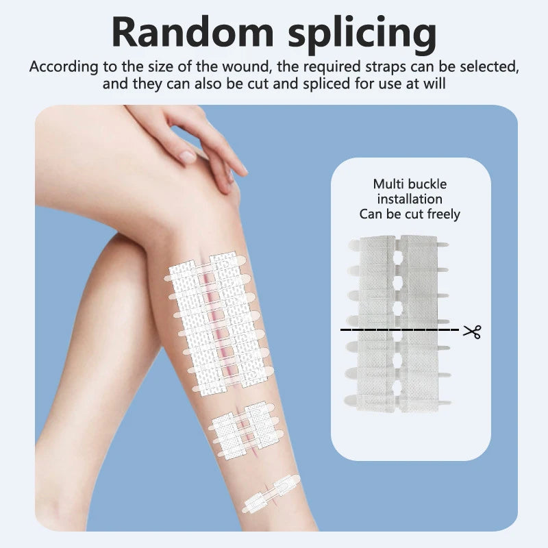 Zip Stitch Wound Bandages Emergency Wound Closures Adhesive Seamless Cuttable Fast Suture Breathable Painless Waterproof Bandaid