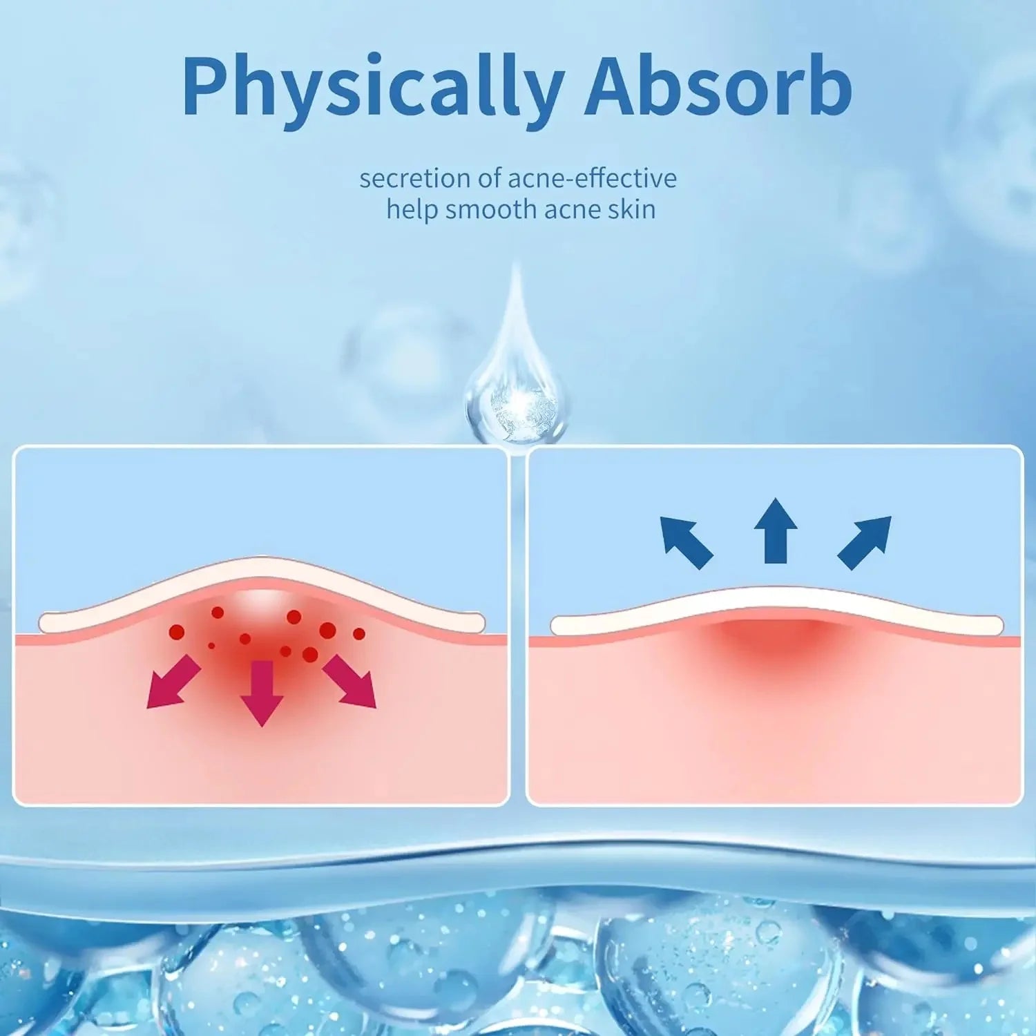 360pcs Face Acne Patch Invisible Skin Care Pimple Acne Patches Anti-inflammatory Healing Absorbing Spot Sticker Covering Acne