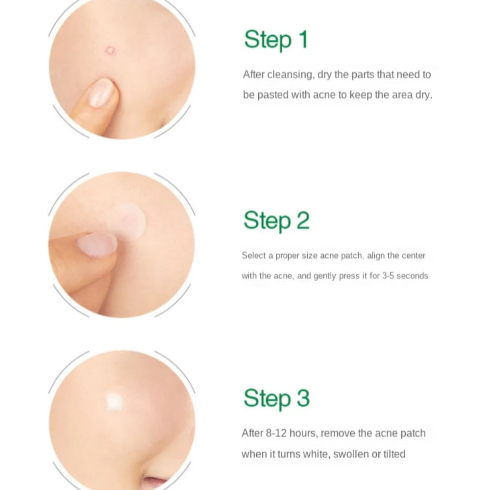 Artificial Skin zits Removal Patch Transparent Beauty Stickers Pimple Patch Concealer Absorbing Liquid zits Cleansing Patch