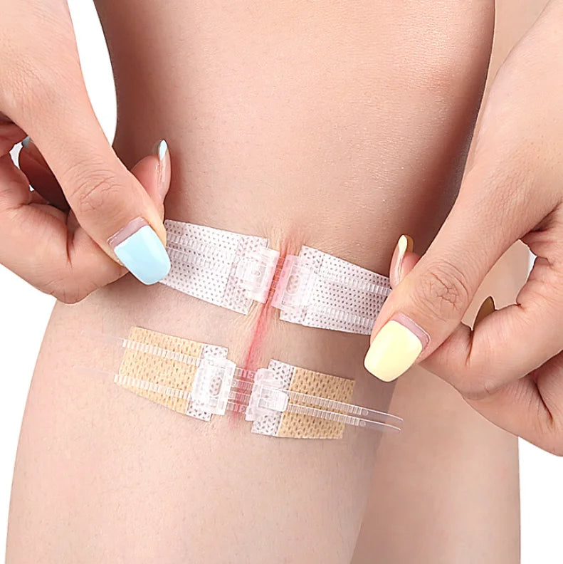 Zipper Tie Wound Closure Patch Hemostatic Patch Wound Fast Without Suture Zipper Outdoor Band-Aid Portable Quick Clot Wound