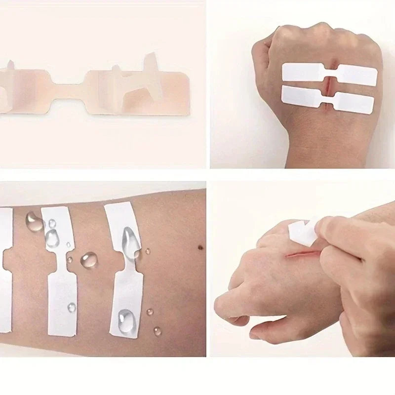 10/30/50/100Pcs Emergency Wound Closure Tape - Outdoor First Aid Adhesive Suture Strips for Quick Wound Repair & Bandage