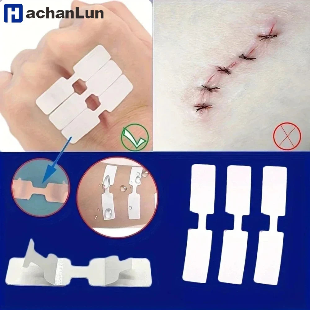10/30/50/100Pcs Emergency Wound Closure Tape - Outdoor First Aid Adhesive Suture Strips for Quick Wound Repair & Bandage
