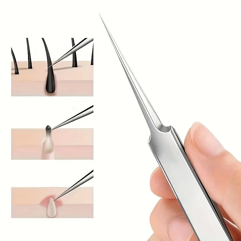 1 Pack Extra Fine No. 5 Cellular Acne Blackhead Tweezers - Facial Beauty Remove Acne Needle Tools for Skin Care