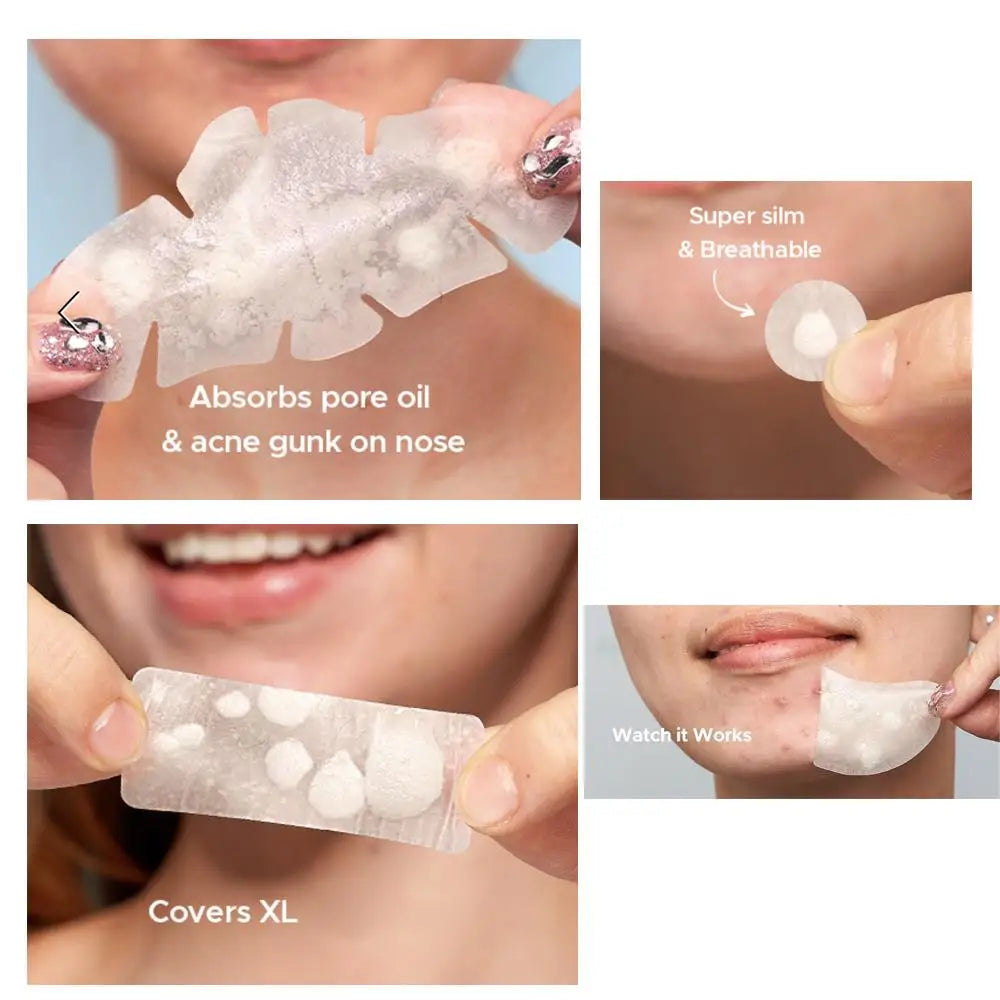 Large Pimple Patches Bulk for Face, 9 Styles Hydrocolloid Acne Patches for Covering Body, Forehead, Chin Blemishes Zit Breakouts