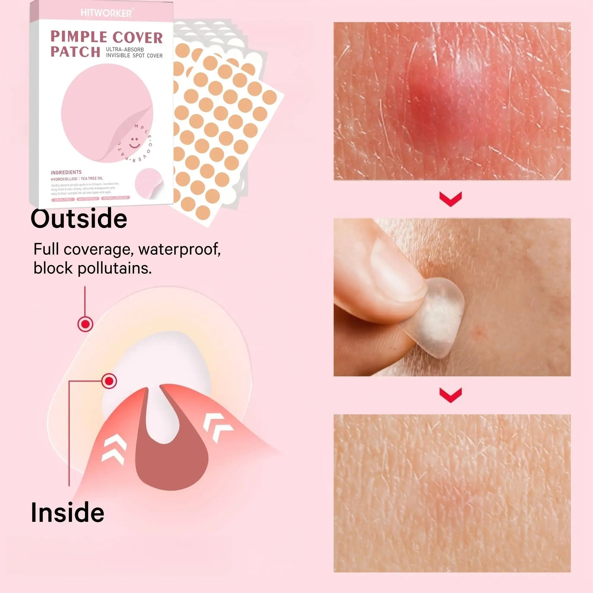 400pcs Hydrocolloid Acne Pimple Patches for Face, Effective Blemish Spot Treatment, Invisible & Skin-Friendly