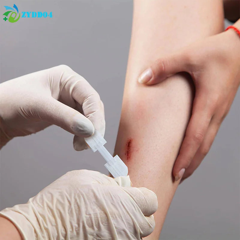 ●Zipper Band-aid Painless Wound Closure Patch Suture-free Wound Dressing Patches Zip Suture Reducer Band Aid Outdoor Portable