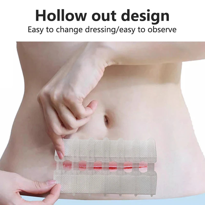 Zip Stitch Wound Bandages Emergency Wound Closures Adhesive Seamless Cuttable Fast Suture Breathable Painless Waterproof Bandaid
