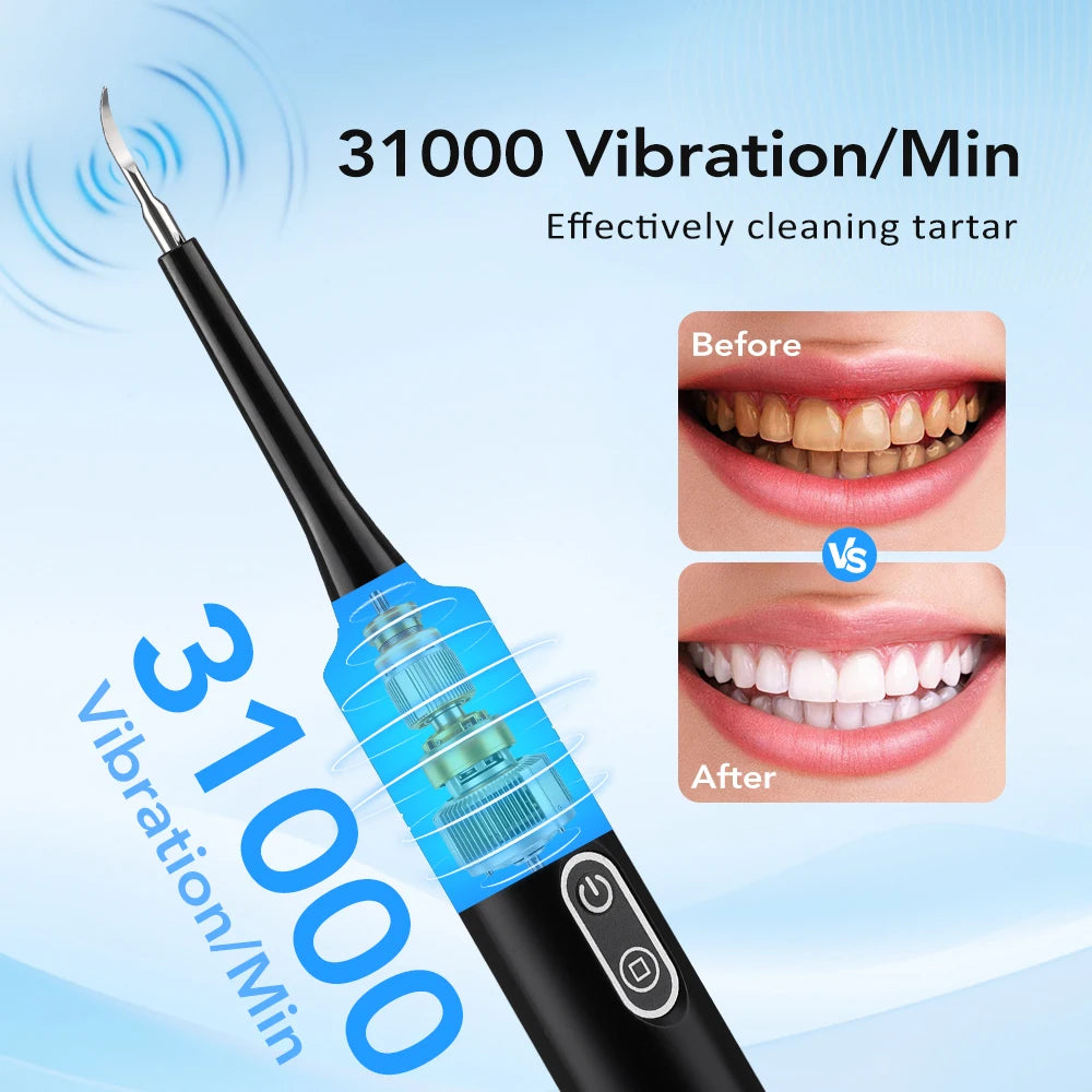 Electric Tooth Cleaner Dental Scaler Calculus Remover Sonic Vibration Toothbrush Plaque Tartar Removal Teeth Whitening Cleaning