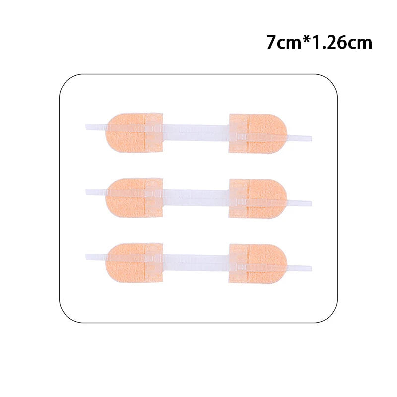 Wound Skin Closure Strips Postpartum Wound Repair Cosmetic Surgery Steri Strip Adhesive Medical Suture Free Surgical Tape