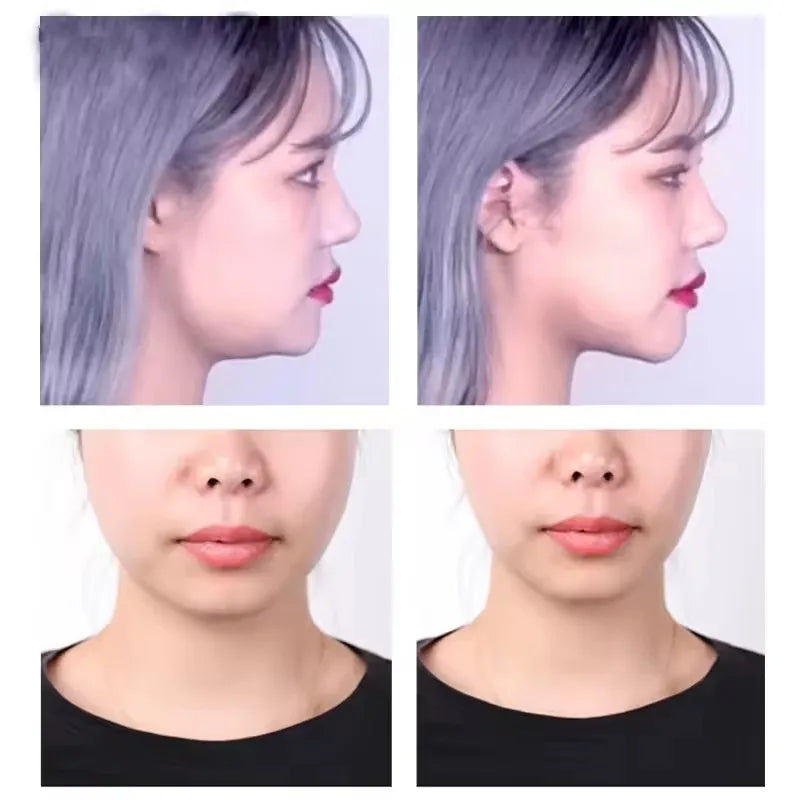 40/120PCS V-Shape Face Wrinkle Sagging Skin Adhesive Tape Lifting Face Stickers Invisible Transparent Thin Face Patche Lift Tool