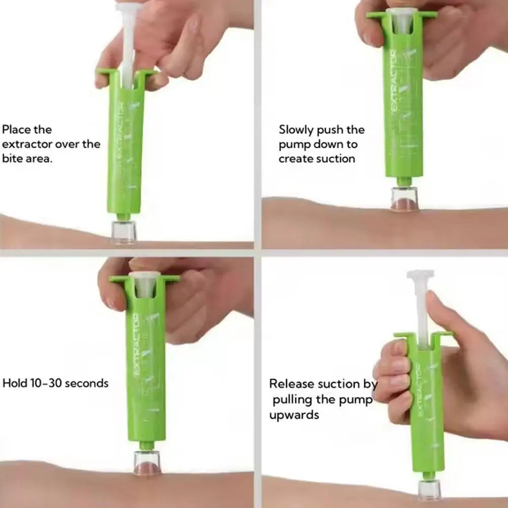 Emergency For Insect Bites Vacuum Negative Pressure Extractor Insect Bite Emergency Treatment For Outdoor Camping Hiking