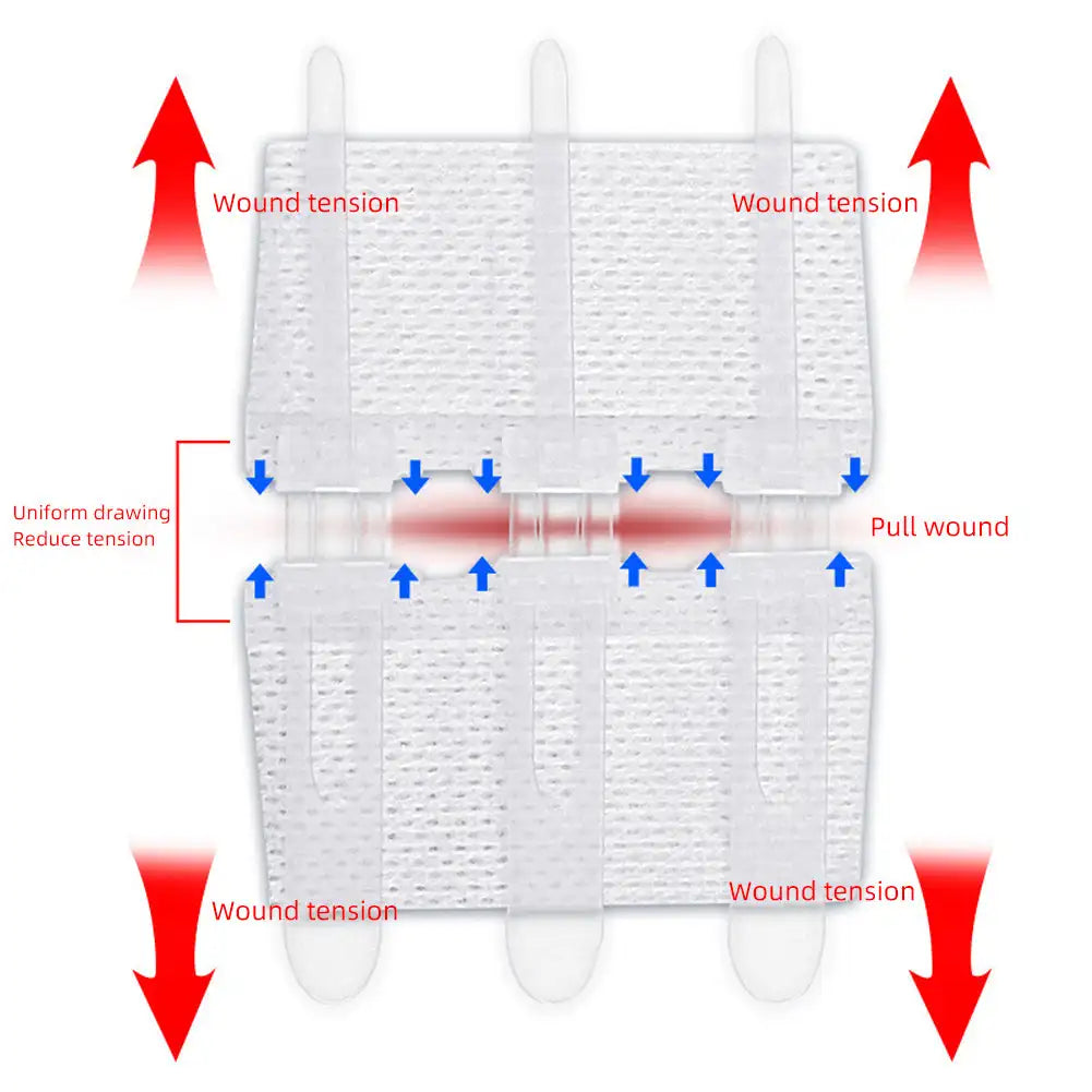 Emergency Laceration Closures Band Zipper Painless Wound Closure Device Suture-free Wound Dressing Closure Strips First Aid Kit