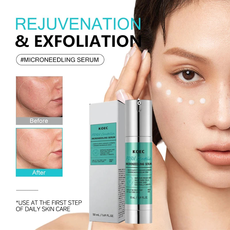 Korean Microneedle Essence Desalination Fine Lines Spots Collagen Solution Reverse Aging Recombinant Improves Rough Texture 50ml