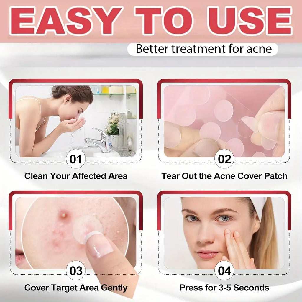 360 pieces/box acne patches - alcohol free, used to absorb acne secretions, gentle and non irritating, essential for acne care