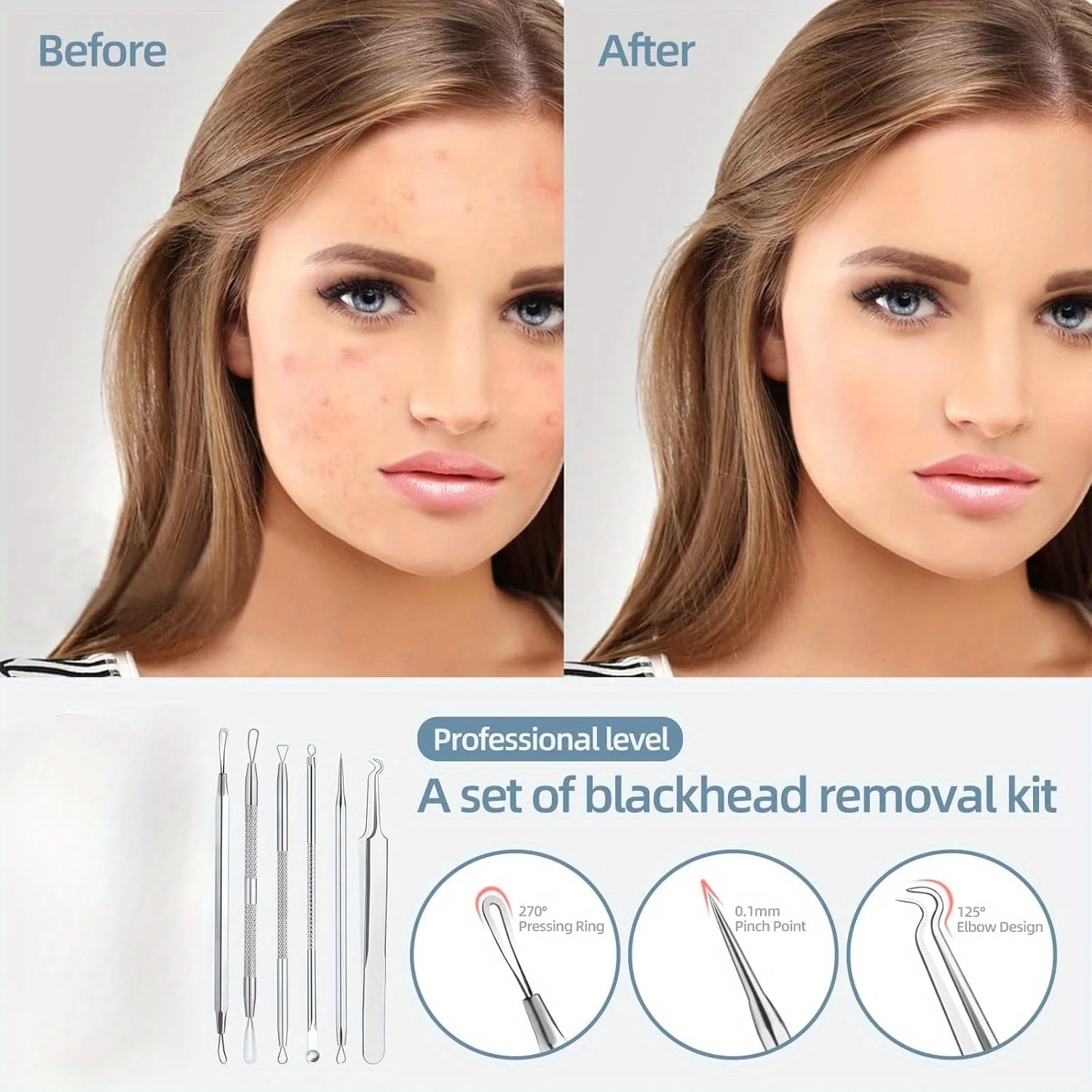 Blackhead Removal Tool Acne Extractor Acne Cleaning Kit, suitable for blemishes, white hole bursts, nose and face tools iron box