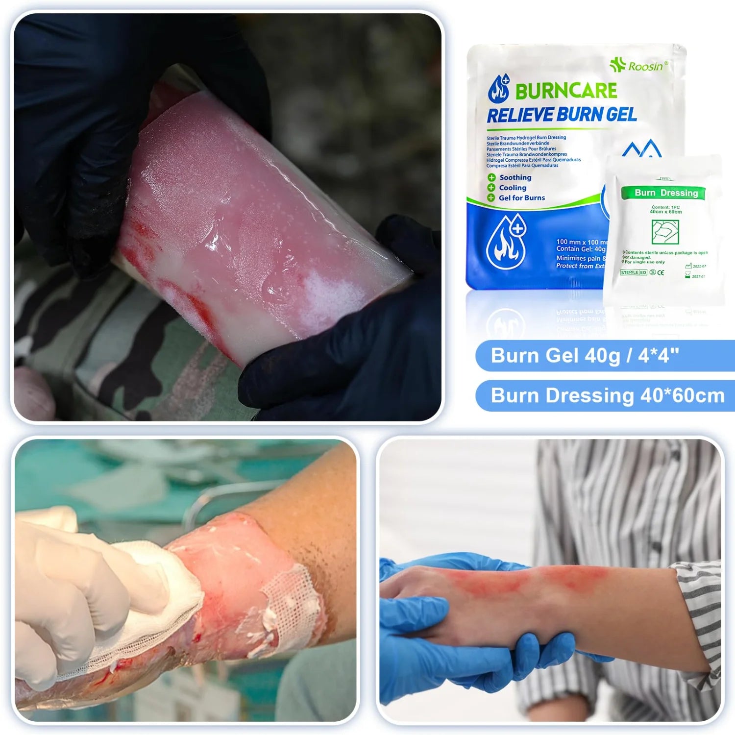 Professional Burn Care Kit with Advanced Dressings Cream & Gauze Portable Emergency Treatment for Home Travel Car Office