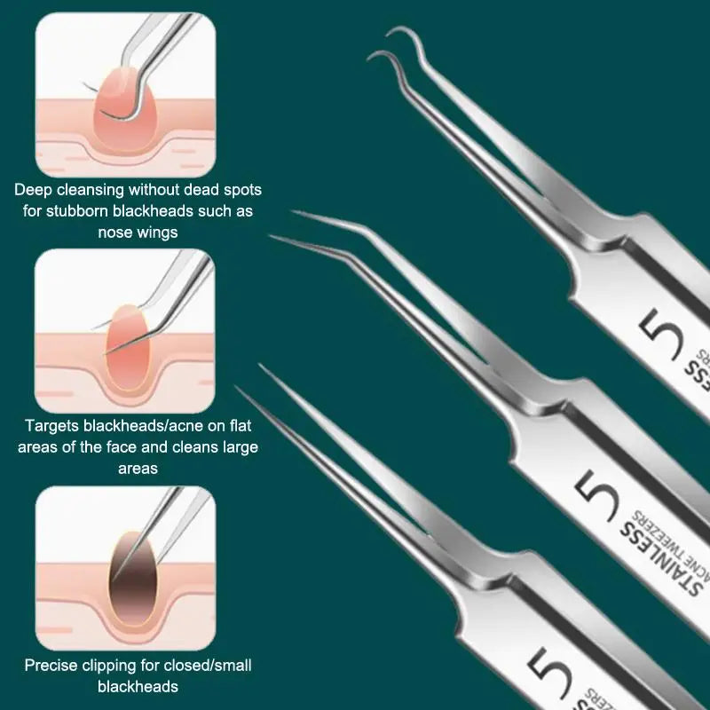 7/8Pcs Blackhead Remover Kit Professional Blackhead  Needle Skin Care Tools Stainless Steel Pimple Extraction Tools