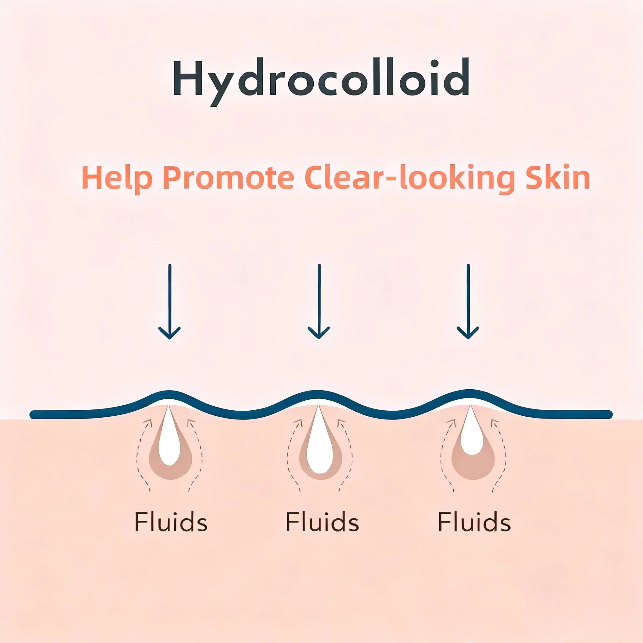 6 Colors 480/960PCS Star-Shaped Hydrocolloid Acne Patches - Cute Star Design, Facial Blemish Coverage