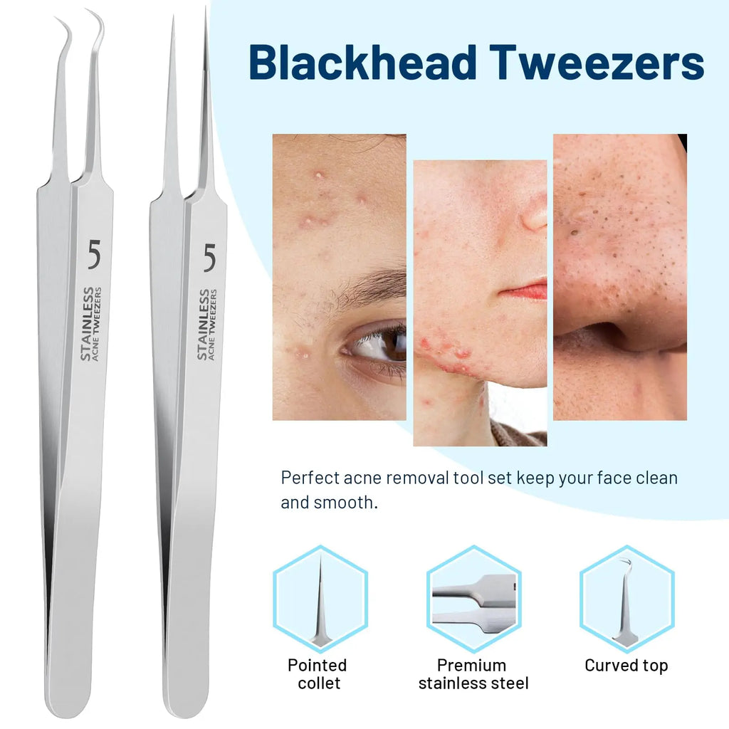 Blackhead Remover Tweezers,Ingrown Hair Tweezers, Precision Blackhead Pimple Extractor, Cell Clips Tweezers, Tweezers for Women