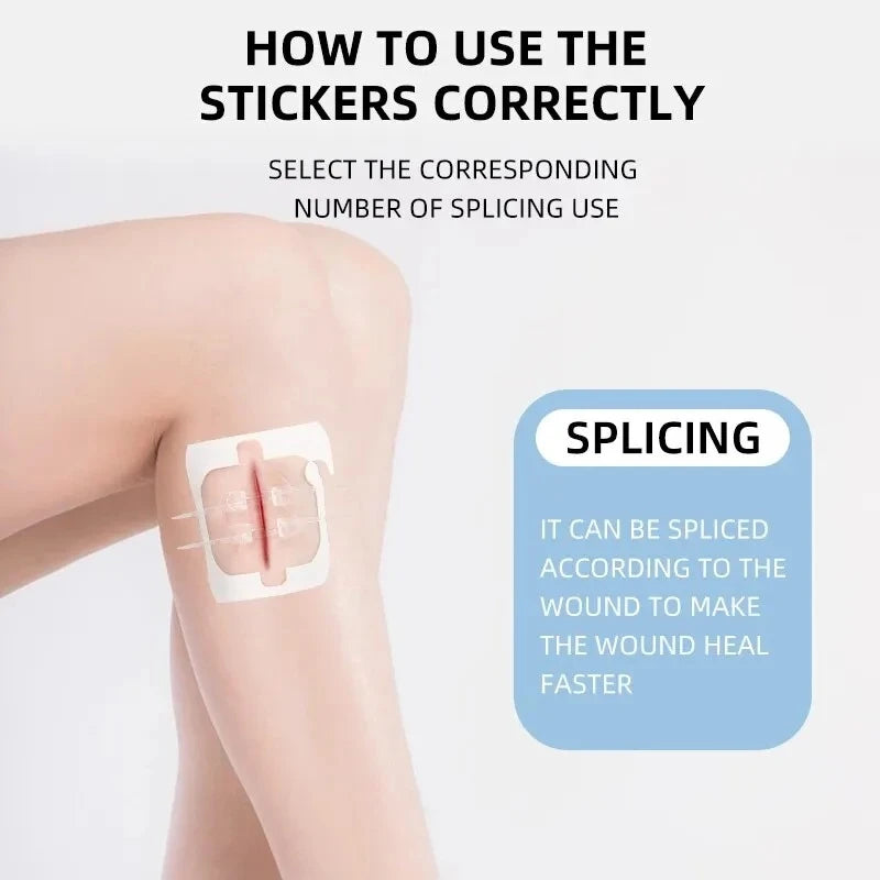 10 Pieces of Outdoor Camping Home Zipper Hemostatic Tape, Wound Closure Tape, Quick Suture Zipper Adhesive Tape, Easy to Carry