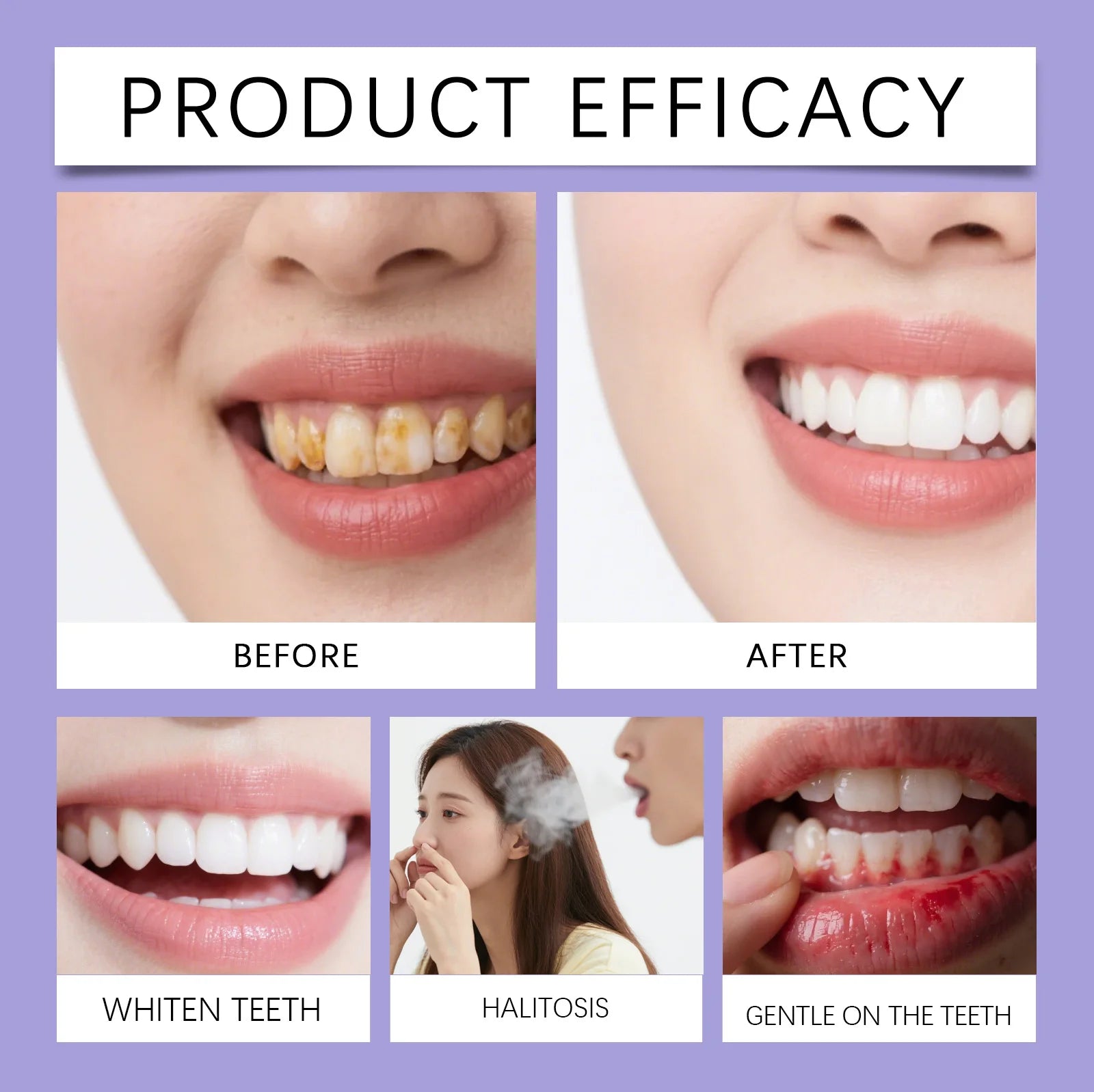 Purple Mouthwash Fresh Mint Flavor Gentle Formula Daily Oral Care Portable 20 Sachets Travel Size No Alcohol Quick Rinse 240ml