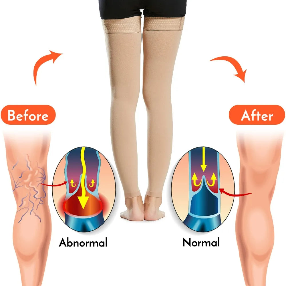 Sport Socks 23-32mmHg Compression Stockings Toeless Footless Thigh High Socks Varicose Vein Socks Flight Travel