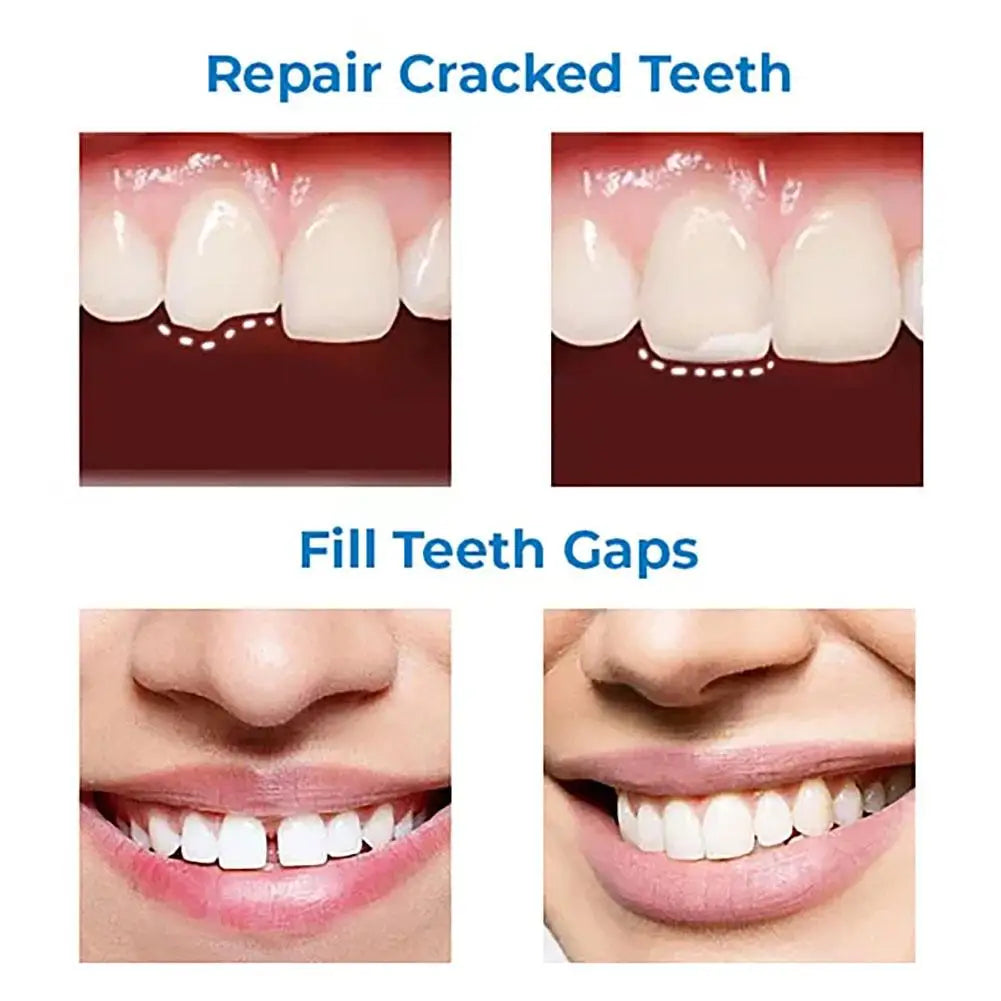 Teeth Repair Glue 30ml for Fixing The Missing and Broken Tooth Replacements Temporary Moldable False Teeth Dental Repair Ki U9Y7