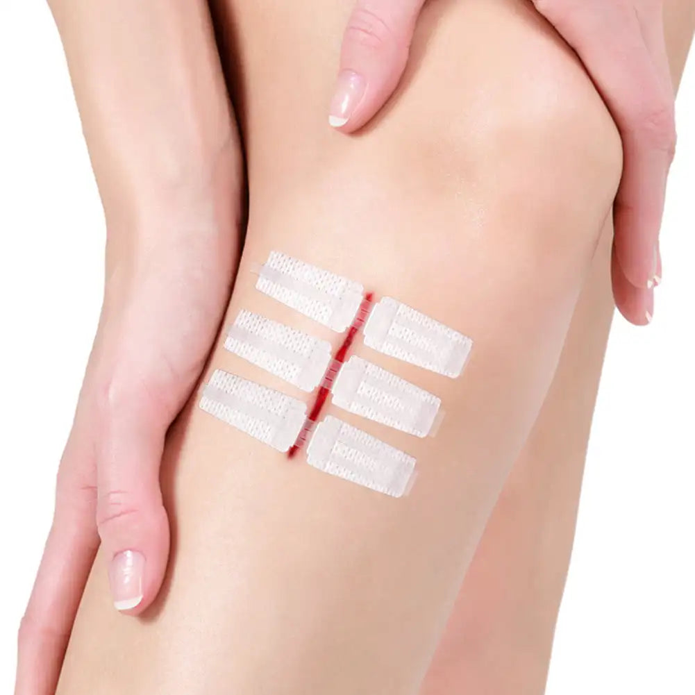 Emergency Laceration Closures Band Zipper Painless Wound Closure Device Suture-free Wound Dressing Closure Strips First Aid Kit
