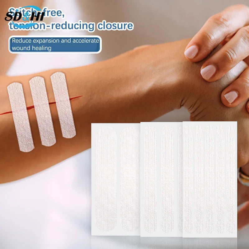 Wound Skin Closure Strips Postpartum Wound Repair Cosmetic Surgery Steri Strip Adhesive Medical Suture Free Surgical Tape