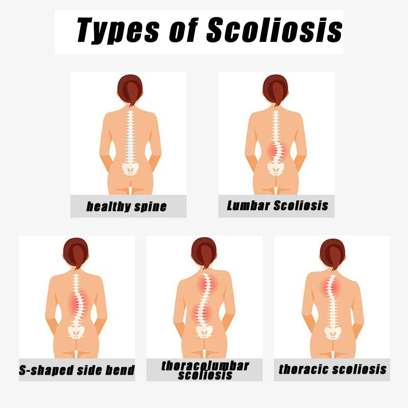 Pocket Scoliometer Medical Measuring Device for Back Scoliosis Diagnosis Portable Device for Measuring Spinal Alignment Measure