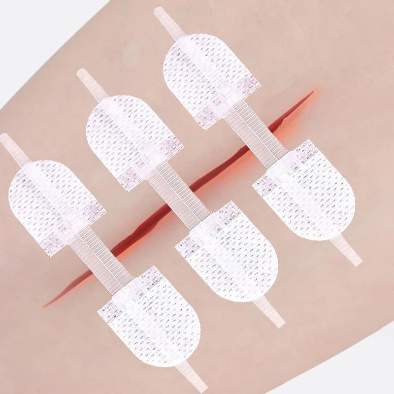 For Wound Care Braces Supports Strap Zipper Wound Closure Patches Breathable Seamless Elastic Zip Sutures Bandages