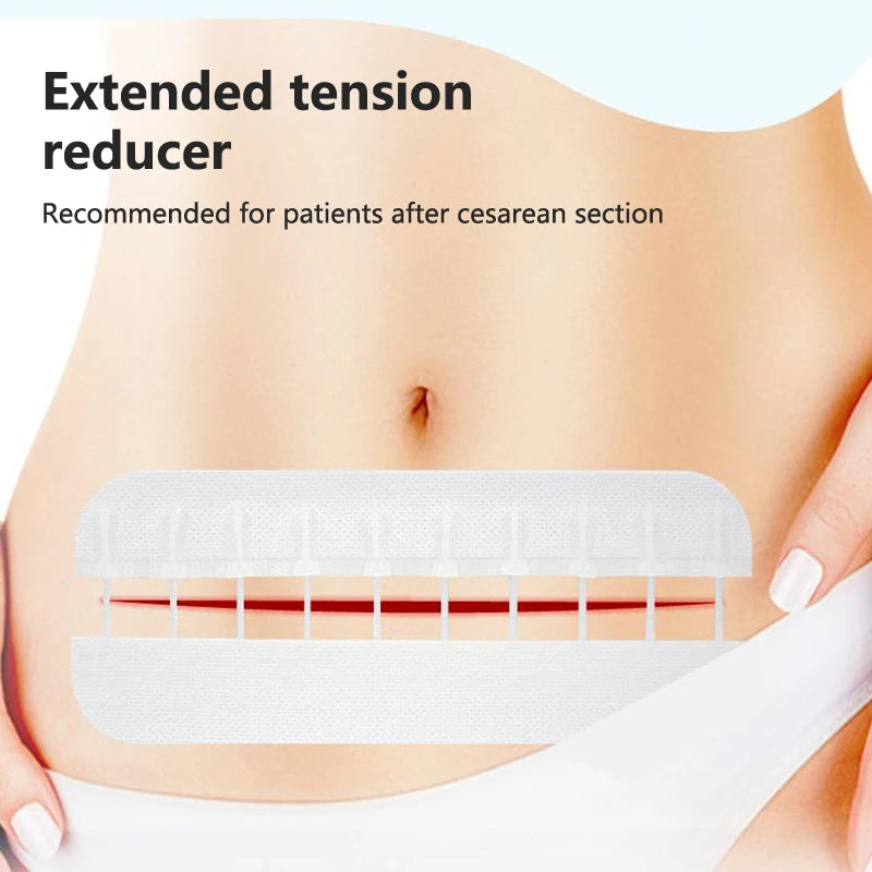 Zip Stitch Wound Bandages Emergency Wound Closures Adhesive Seamless Cuttable Fast Suture Breathable Painless Waterproof Bandaid