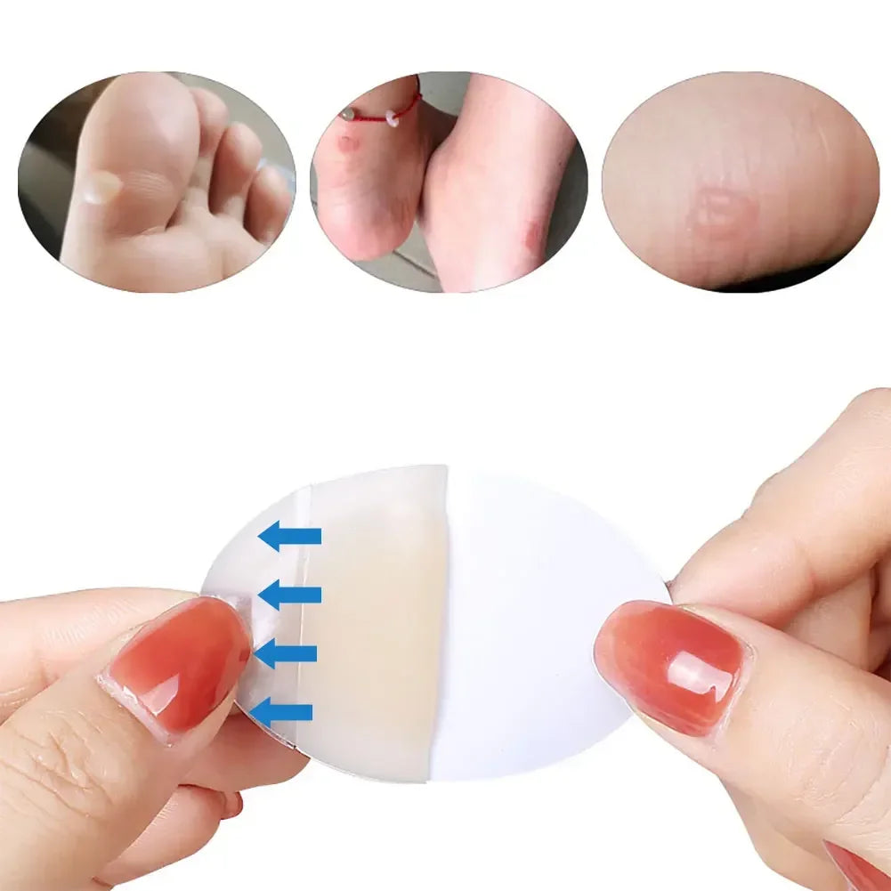 20/10pcs Hydrocolloid Foot Patch Heel Stickers Band-Aid Anti-Wear Adhesive Pain Bandage Emergency Kits Outdoor Camping First Aid